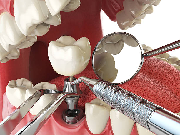 Best 24-Hour Emergency Dentist in St James, MD